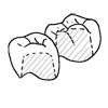 補綴（上部）